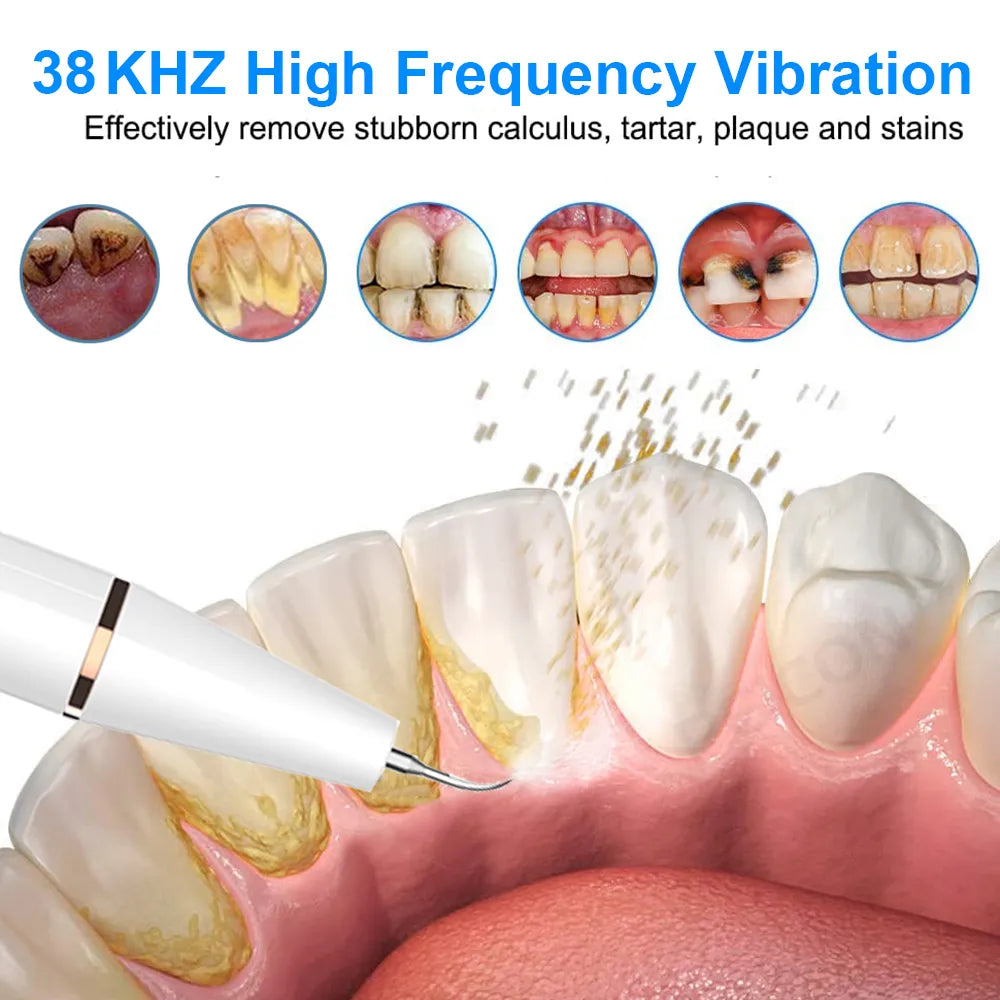 Ultrasonic Electric Dental Cleaner & Calculus Remover